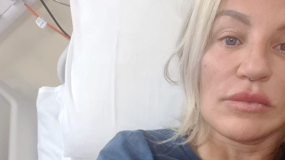 Džoan je posle ubrizgavanja filera dobila sepsu i smeštena je u bolnicu 