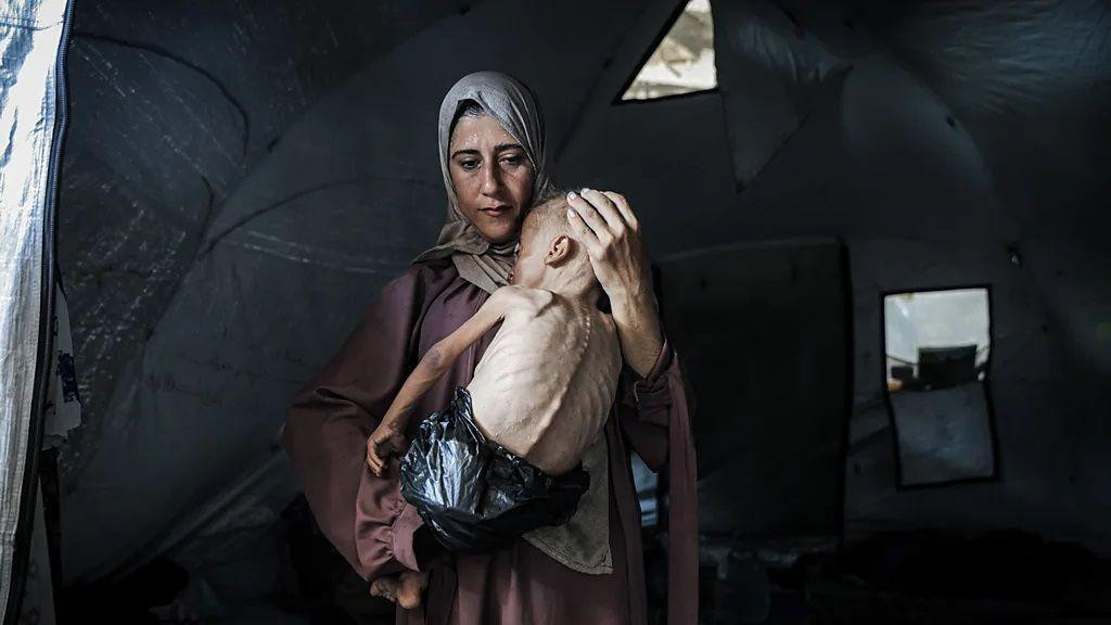 dete u gazi, izglednelo dete u gazi, majka drži mršavo dete u naručju u gazi