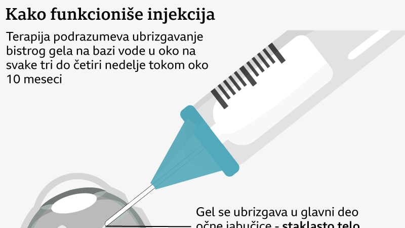 injekcija za oko, gel terapija za oko
